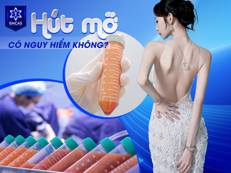 Hút mỡ có thể nguy hiểm nếu chỉ định không phù hợp, thực hiện tại cơ sở không đủ điều kiện hoặc không được theo dõi hậu phẫu đúng cách. 
