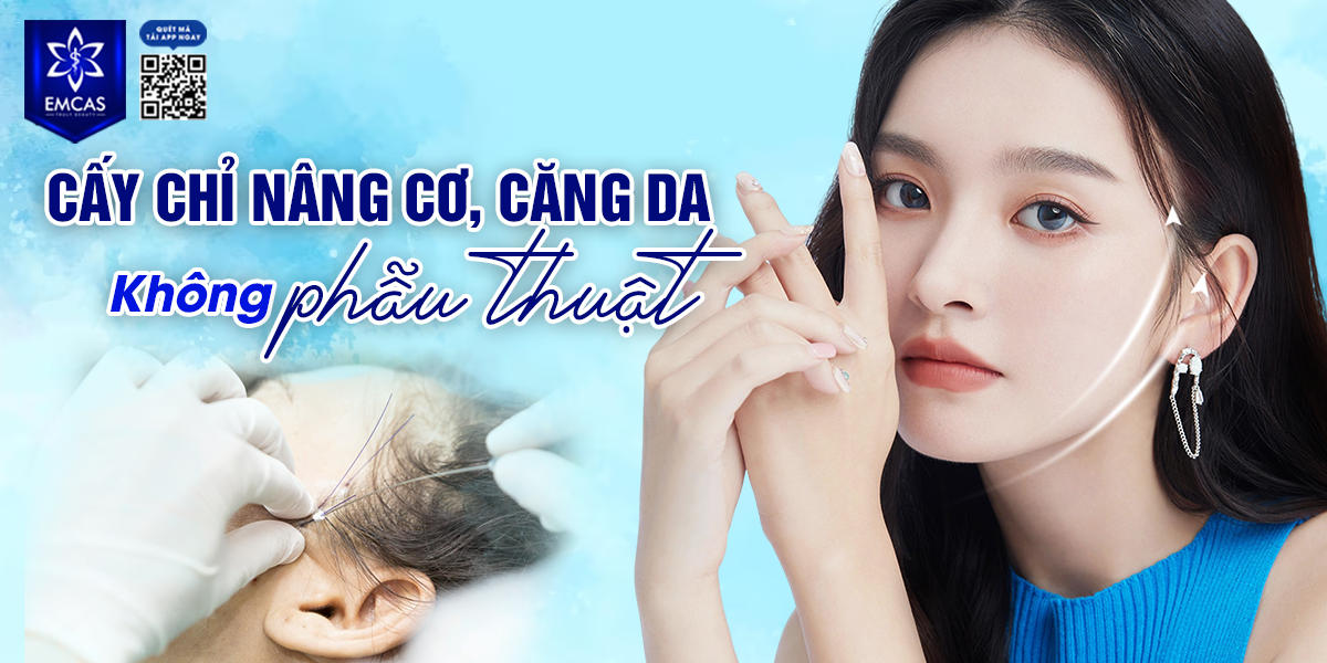 Cấy Chỉ Nâng Cơ, Căng Da Không Phẫu Thuật