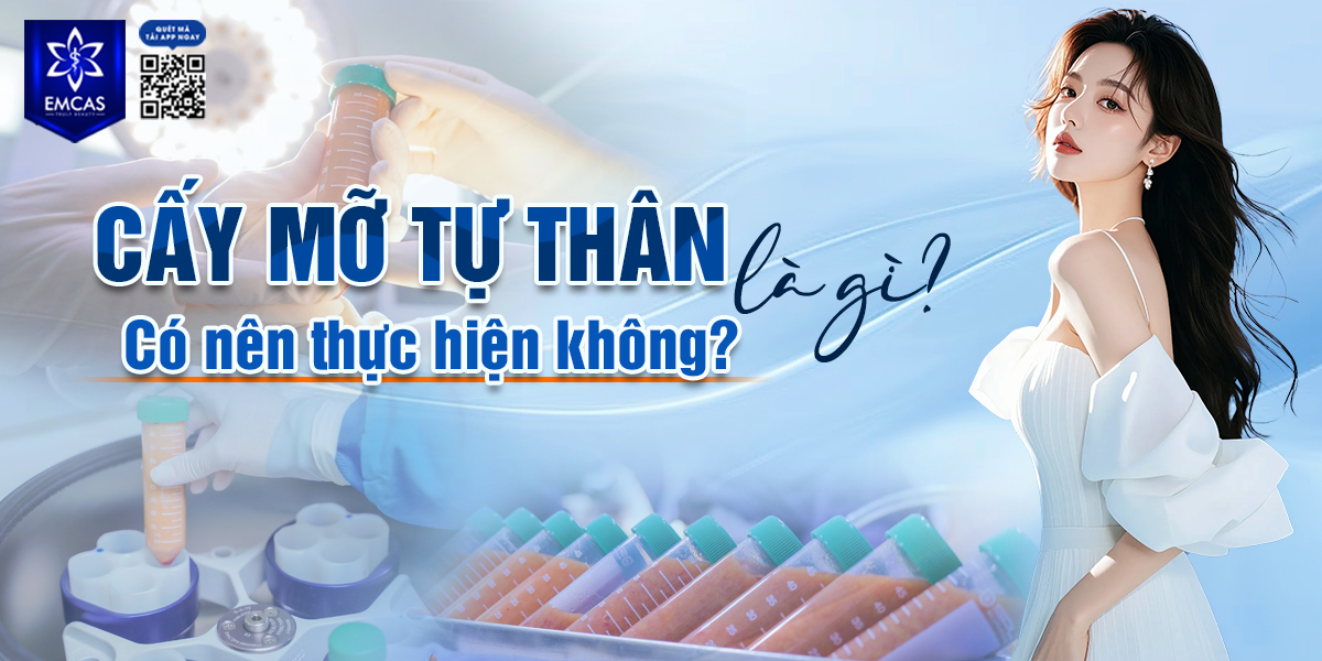 Cấy Mỡ Tự Thân Là Gì? Có Nên Thực Hiện Không?