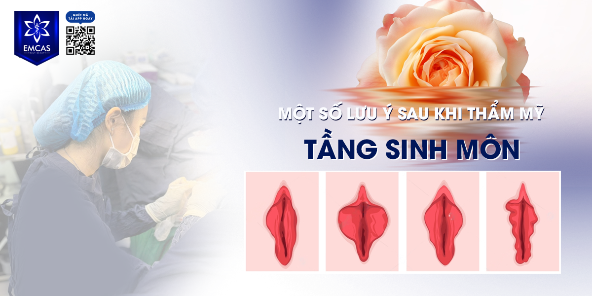 Một Số Lưu Ý Sau Khi Thẩm Mỹ Tầng Sinh Môn