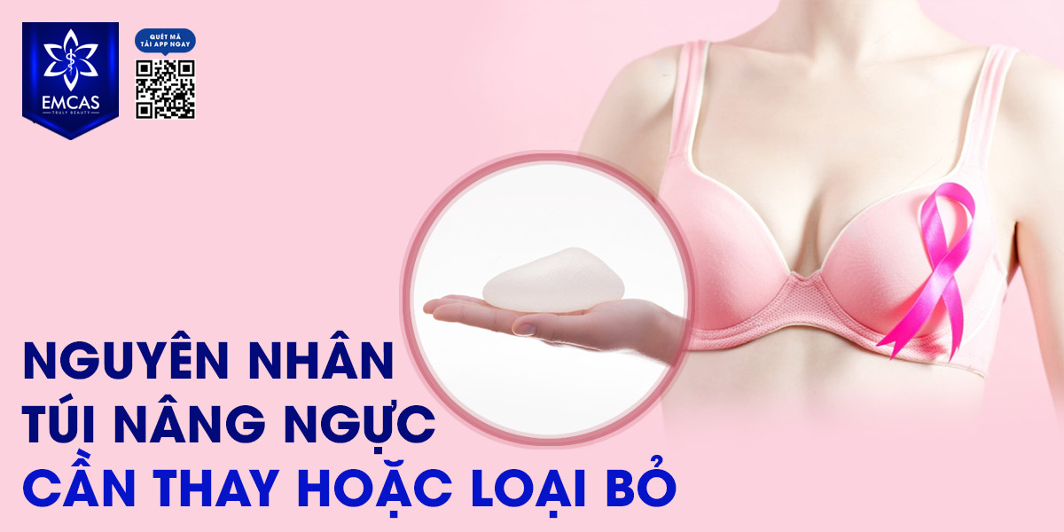 Nguyên Nhân Túi Ngực Cần Thay Hoặc Loại Bỏ