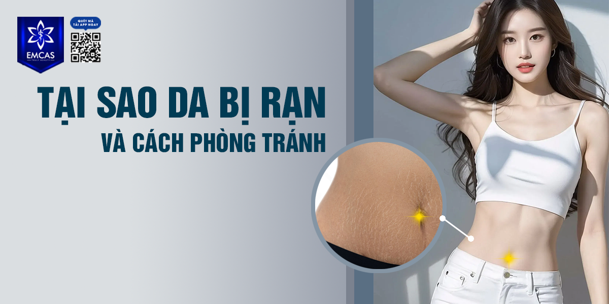 Tại Sao Da Bị Rạn Và Cách Phòng Tránh