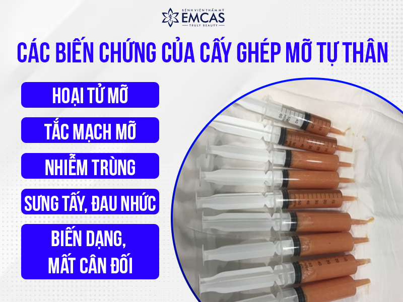 Biến Chứng Cấy Mỡ Tự Thân - Những Điều Cần Biết