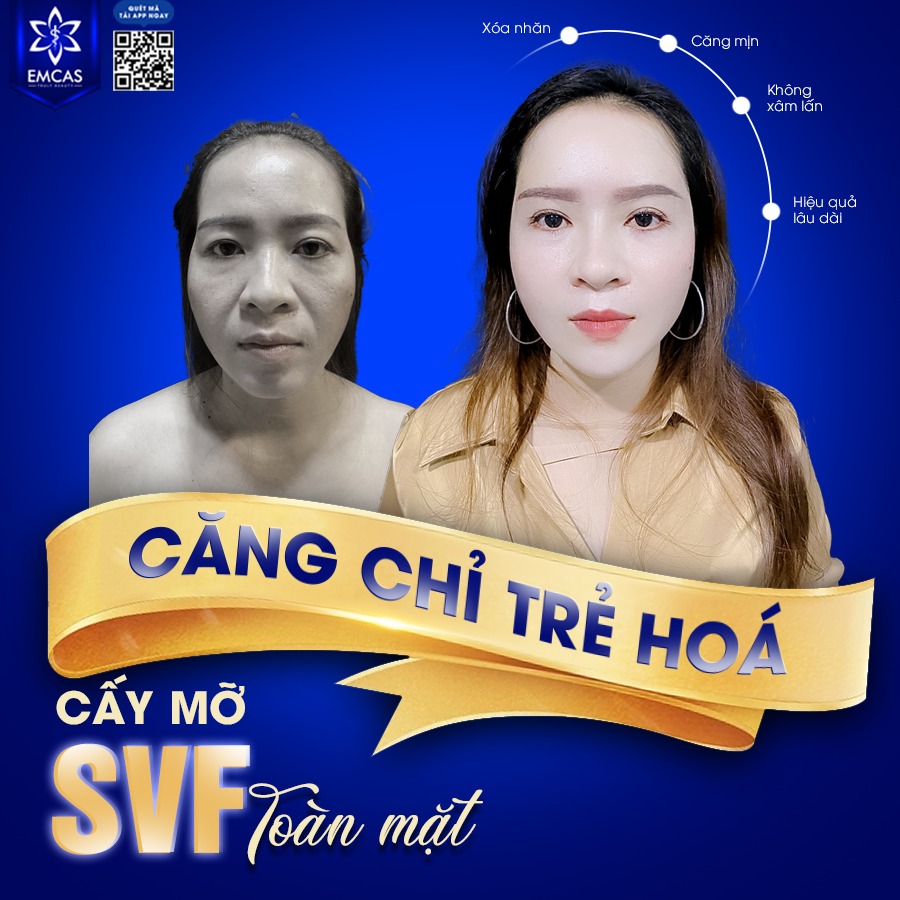Căng Da Mặt Có Thật Sự Hiệu Quả