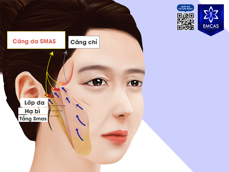 Ưu Điểm Khi Thực Hiện Căng Da Mặt Tại EMCAS