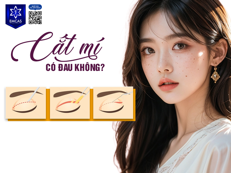 Cắt Mí Mắt Có Đau Không? Những Lưu Ý Quan Trọng Sau Phẫu Thuật