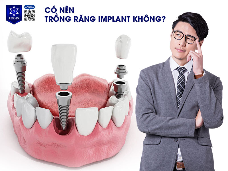 Trồng răng Implant là sự lựa chọn phù hợp với nhiều người khi gặp tình trạng mất răng, đặc biệt là ở độ tuổi trung niên trở lên