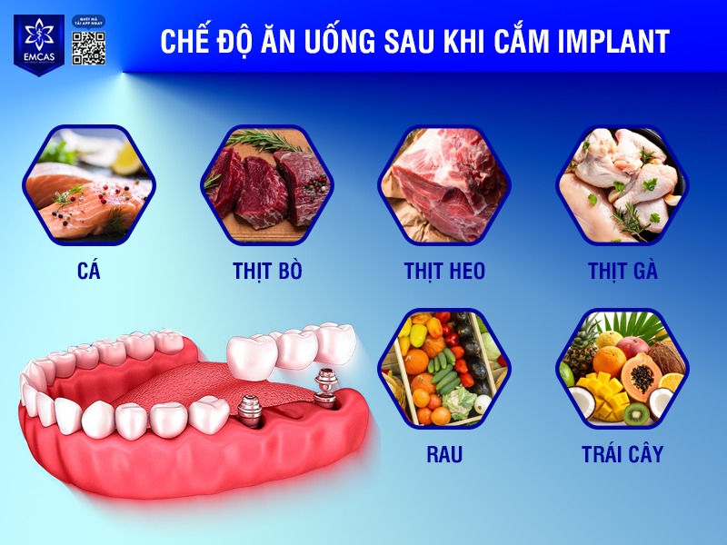 Trong tuần đầu, nên chọn các loại thức ăn mềm, lỏng, dễ tiêu hóa, hạn chế nhai