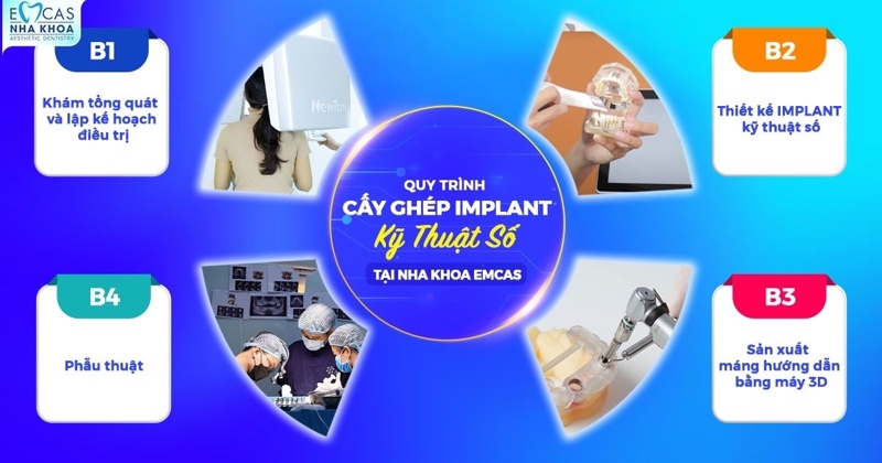 Quy trình trồng răng Implant cho người cao tuổi được thực hiện theo các bước khoa học và an toàn