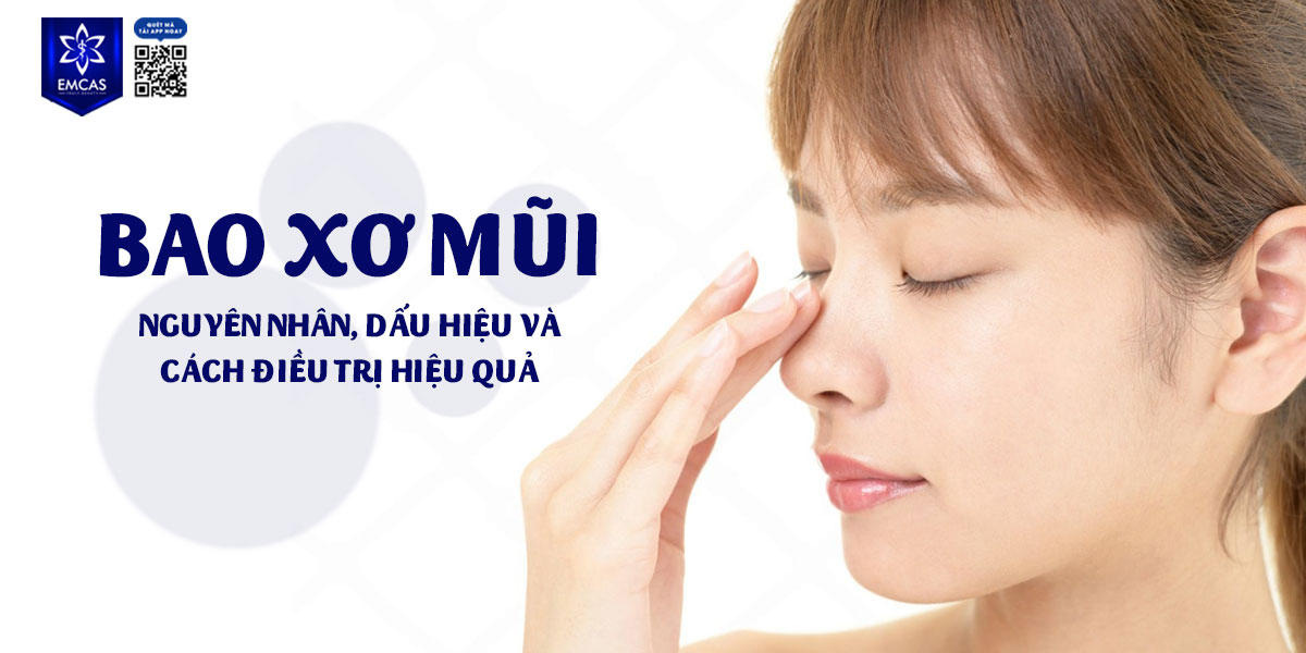 BAO XƠ MŨI: NGUYÊN NHÂN, DẤU HIỆU VÀ CÁCH ĐIỀU TRỊ HIỆU QUẢ
