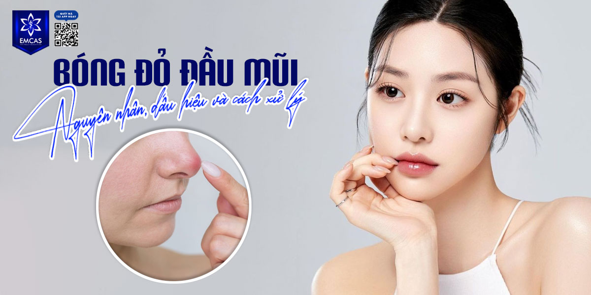NÂNG MŨI BỊ BÓNG ĐỎ ĐẦU MŨI: NGUYÊN NHÂN, DẤU HIỆU VÀ CÁCH XỬ LÝ