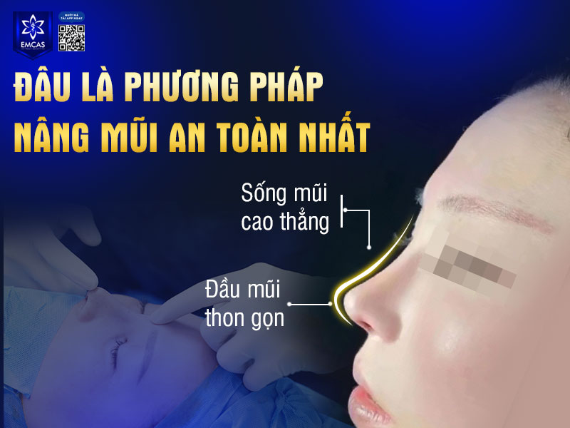 Nếu được thực hiện tại cơ sở thẩm mỹ uy tín sẽ giúp đảm bảo an toàn cho bạn
