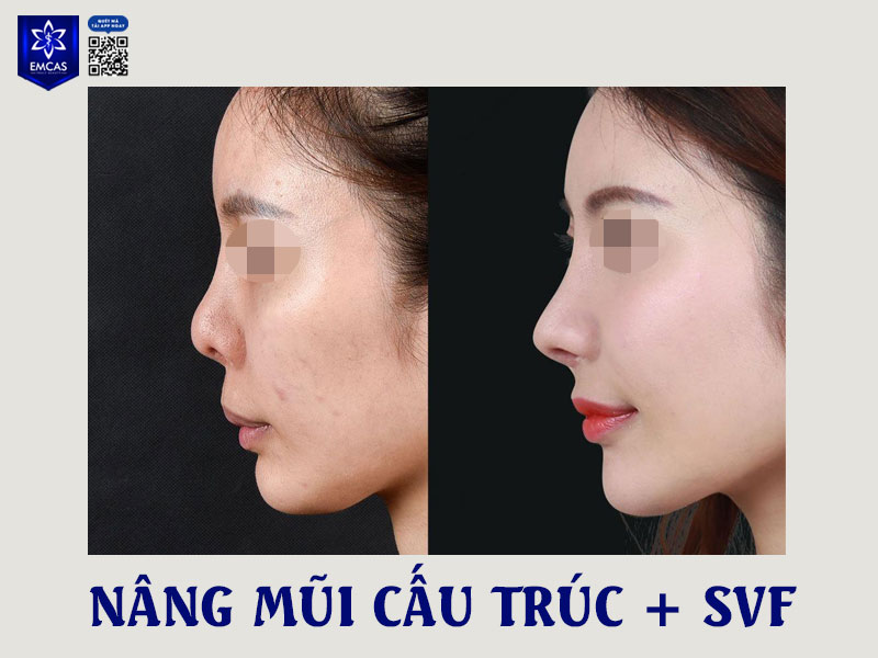 Việc sở hữu tướng mũi đẹp không chỉ giúp gương mặt cân đối, thanh tú hơn mà còn được cho là mang lại phúc khí và vận trình hanh thông