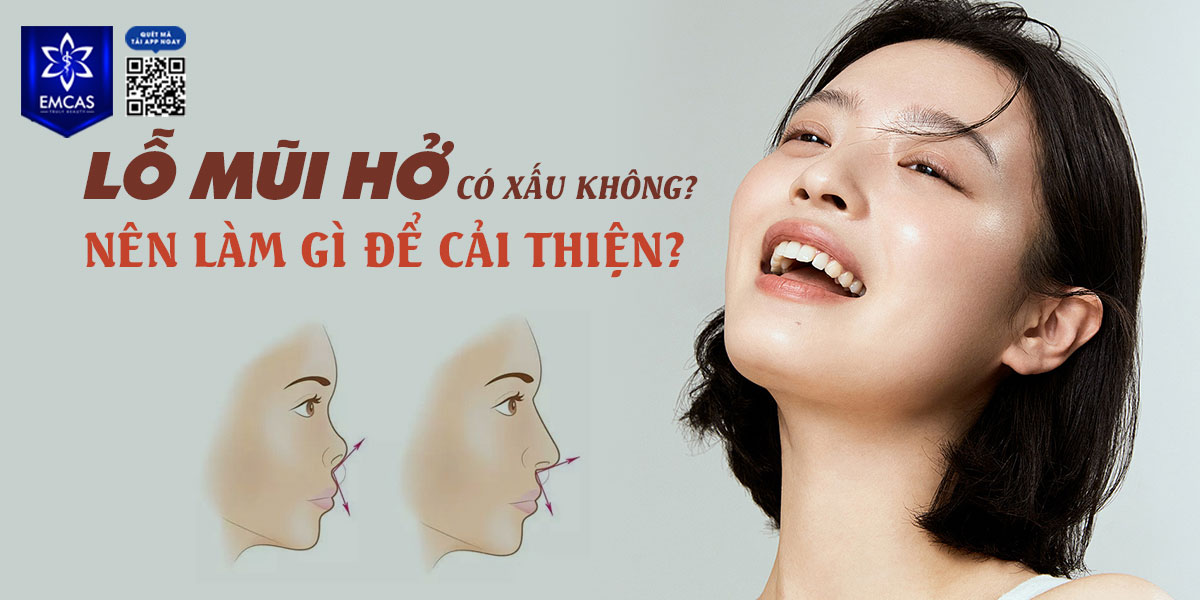 LỖ MŨI HỞ CÓ XẤU KHÔNG? NÊN LÀM GÌ ĐỂ CẢI THIỆN?