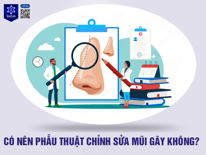 Nếu bạn cảm thấy mũi gãy khiến bạn cảm thấy tự ti và không hài lòng thì việc can thiệp phẫu thuật là hoàn toàn nên cân nhắc
