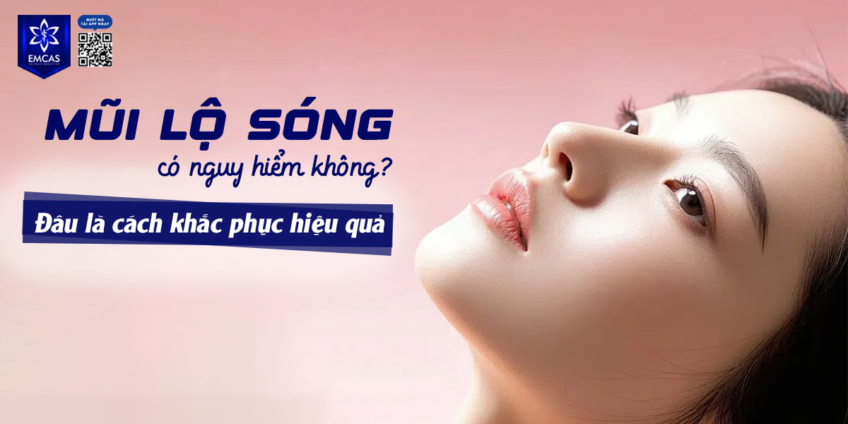 MŨI LỘ SÓNG CÓ NGUY HIỂM KHÔNG? CÁCH KHẮC PHỤC HIỆU QUẢ