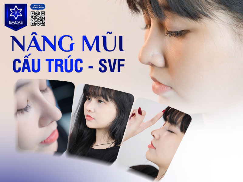 Bạn nên kiêng mì tôm ít nhất 4 tuần đầu – cho đến khi mô mũi khô, sẹo liền và dáng mũi bước vào giai đoạn ổn định.