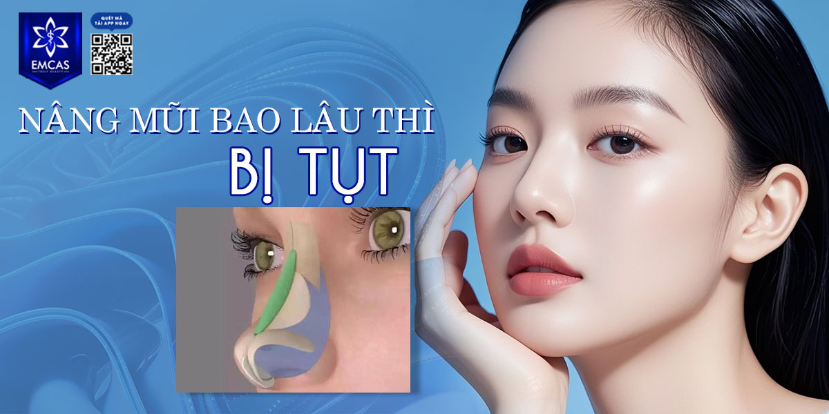 NÂNG MŨI BAO LÂU THÌ BỊ TỤT? [GIẢI ĐÁP]