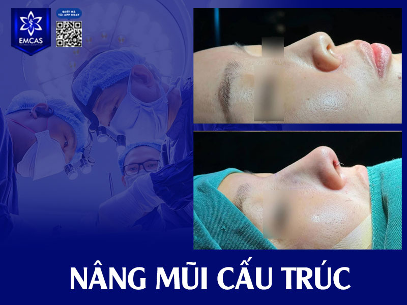 Việc tự ý tháo chỉ tại nhà mà không có sự giám sát chuyên môn là điều tuyệt đối không nên.
