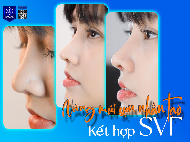 Dù phải tạm ngưng bơi trong thời gian đầu, bạn vẫn có nhiều lựa chọn vận động phù hợp để duy trì sức khỏe.