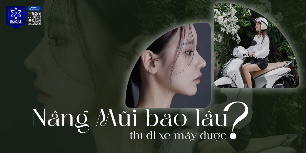 NÂNG MŨI BAO LÂU THÌ ĐI XE MÁY ĐƯỢC? [GIẢI ĐÁP]