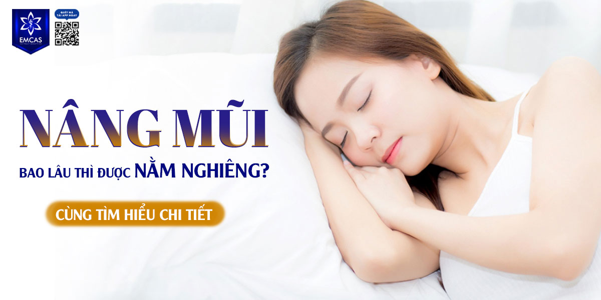 NÂNG MŨI BAO LÂU THÌ ĐƯỢC NẰM NGHIÊNG? CÙNG TÌM HIỂU CHI TIẾT