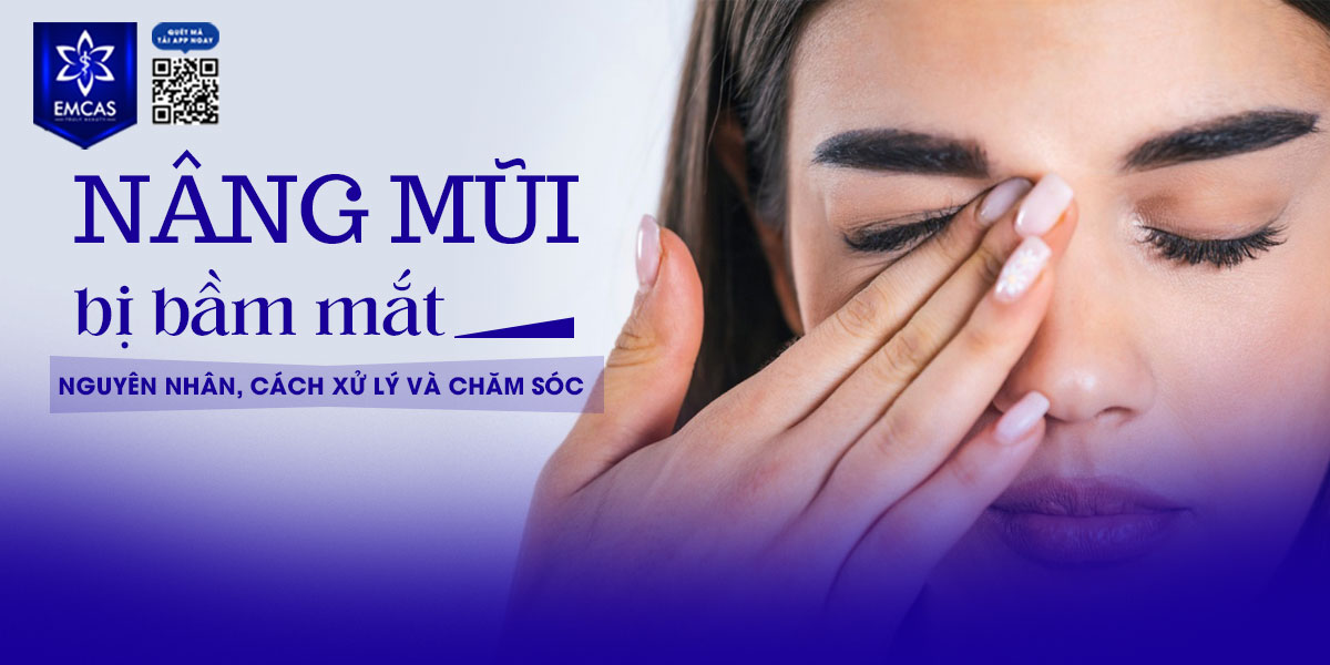 NÂNG MŨI BỊ BẦM MẮT: NGUYÊN NHÂN, CÁCH XỬ LÝ VÀ CHĂM SÓC