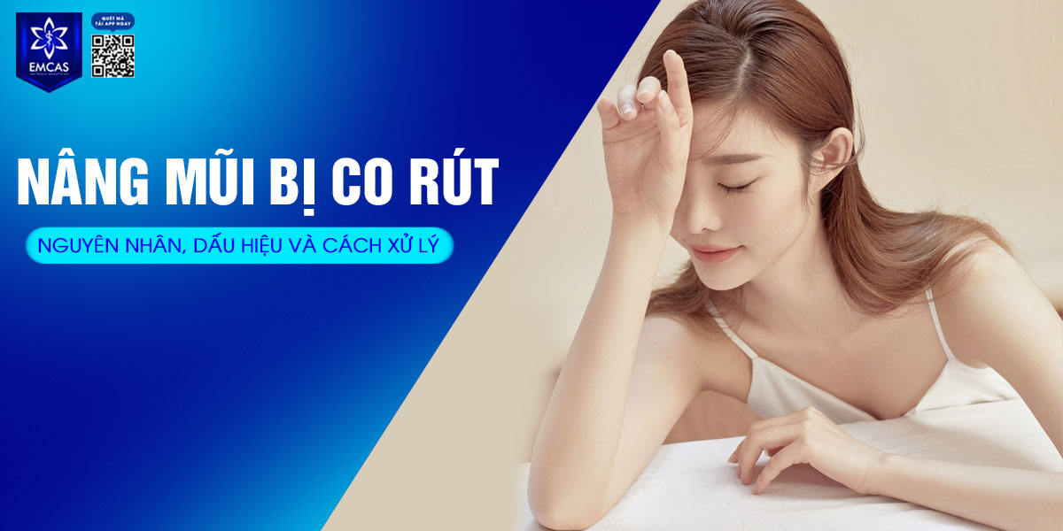 NÂNG MŨI BỊ CO RÚT: NGUYÊN NHÂN, DẤU HIỆU VÀ CÁCH XỬ LÝ