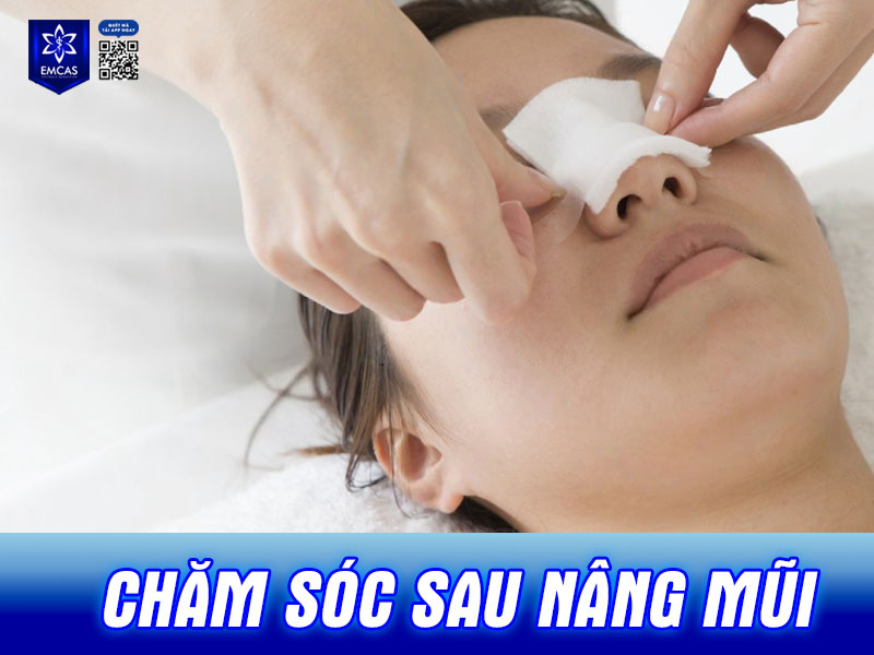 Một số mẹo chăm sóc giúp vết thương mau lành, giảm cảm giác đau, khó chịu sau nâng mũi