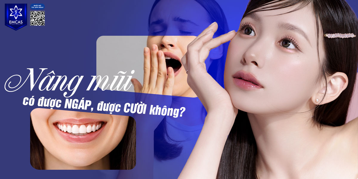 NÂNG MŨI CÓ ĐƯỢC NGÁP, ĐƯỢC CƯỜI KHÔNG? [GIẢI ĐÁP]