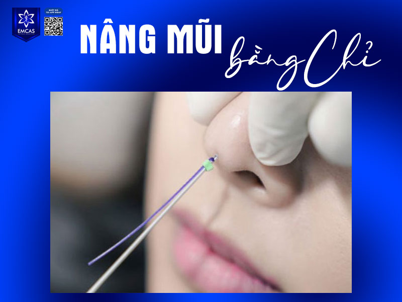 Nâng mũi bằng chỉ sử dụng chỉ sinh học an toàn với cơ thể