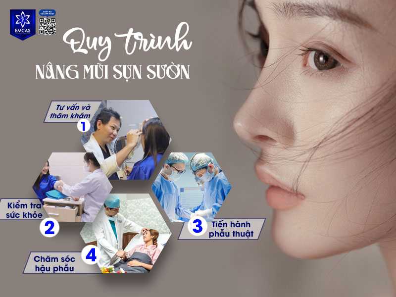 Bệnh Viện Thẩm Mỹ EMCAS là một trong những cơ sở uy tín tại TP.HCM, được cấp phép bởi Bộ Y tế, với đội ngũ bác sĩ chuyên nghiệp, trang thiết bị hiện đại và quy trình phẫu thuật đạt chuẩn