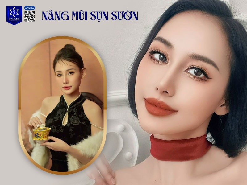 Để đảm bảo an toàn và hạn chế những nhược điểm của nâng mũi bằng sụn sườn, bạn nên lựa chọn cơ sở thẩm mỹ uy tín, nơi có đội ngũ y bác sĩ chuyên môn sâu, tay nghề giỏi và giàu kinh nghiệm.