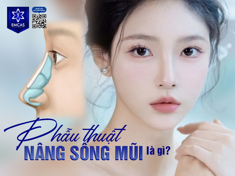 Nâng sống mũi là thủ thuật thẩm mỹ nhằm cải thiện chiều cao và hình dáng của sống mũi