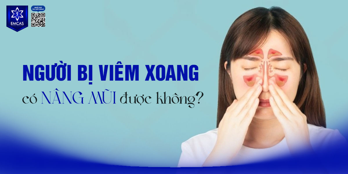 NGƯỜI BỊ VIÊM XOANG CÓ NÂNG MŨI ĐƯỢC KHÔNG? [GIẢI ĐÁP]