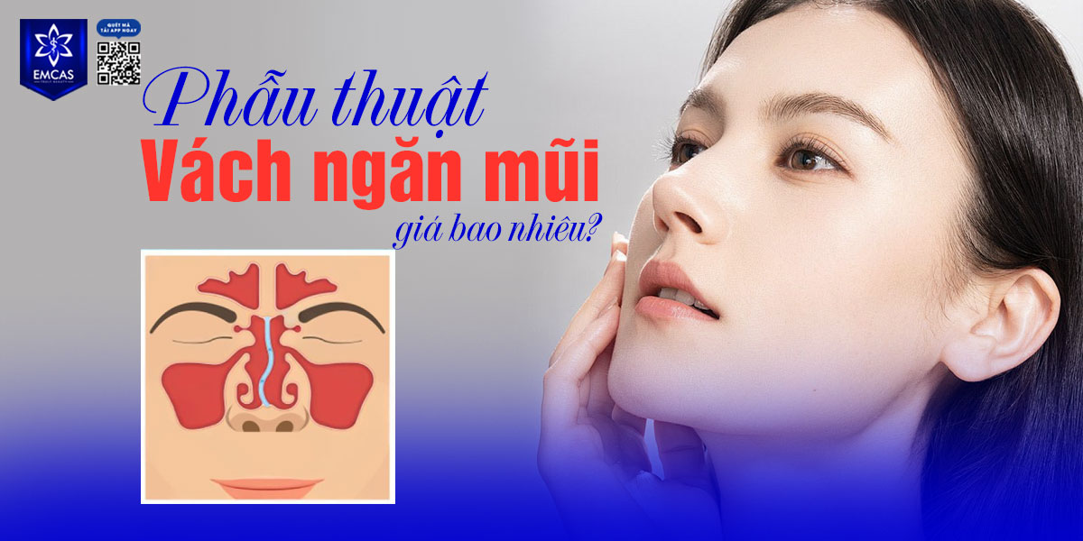 PHẪU THUẬT VÁCH NGĂN MŨI GIÁ BAO NHIÊU? BAO LÂU THÌ LÀNH?