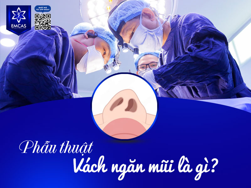 Phẫu thuật vách ngăn mũi là một thủ thuật ngoại khoa nhằm chỉnh sửa tình trạng vách mũi bị cong vẹo, lệch sang một bên