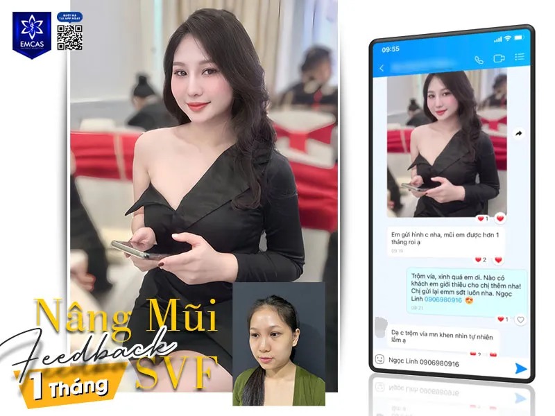 Feedback nâng mũi tại EMCAS