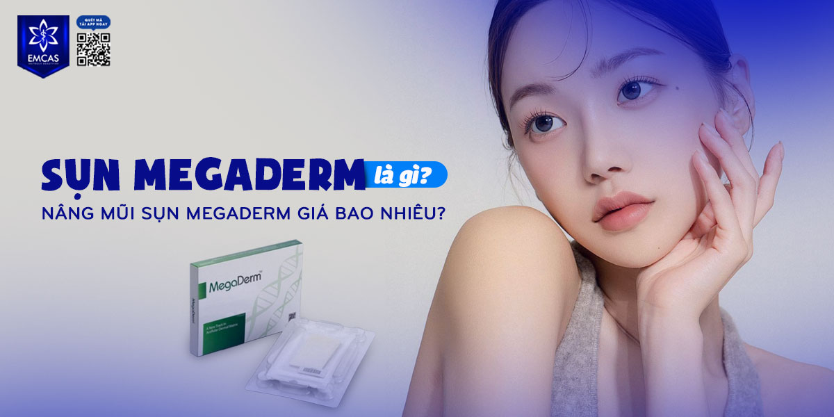 SỤN MEGADERM LÀ GÌ? NÂNG MŨI SỤN MEGADERM GIÁ BAO NHIÊU?