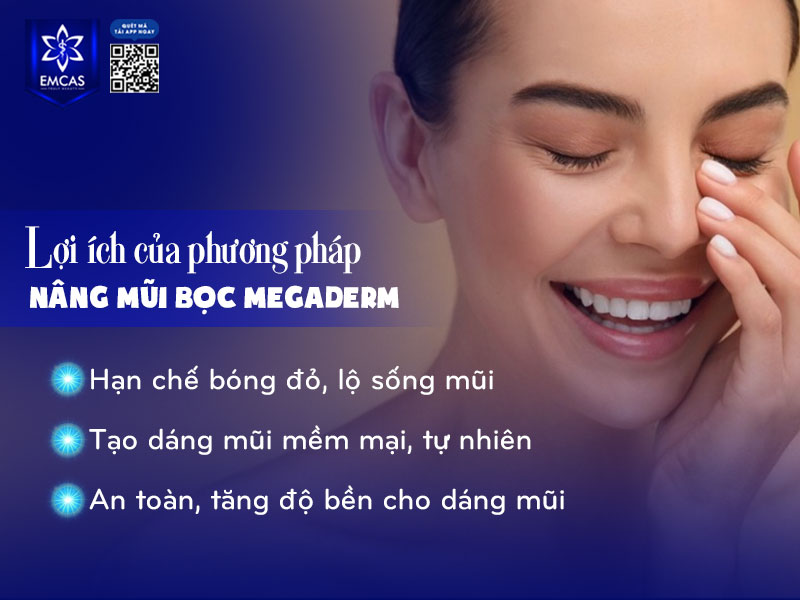 Nâng mũi bọc Megaderm mang lại nhiều ưu điểm vượt trội cả về thẩm mỹ lẫn độ an toàn.