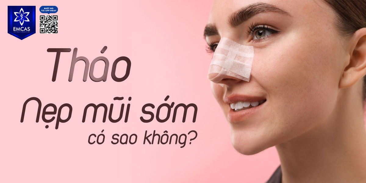 THÁO NẸP MŨI SỚM CÓ SAO KHÔNG? BAO NHIÊU NGÀY THÁO ĐƯỢC?