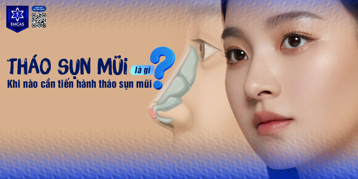 THÁO SỤN MŨI LÀ GÌ? KHI NÀO CẦN TIẾN HÀNH THÁO SỤN MŨI?