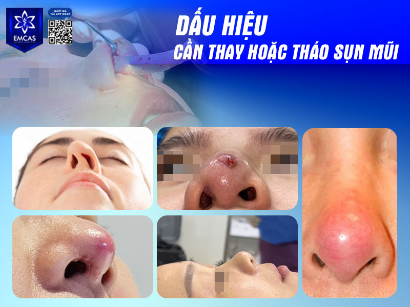 Khi gặp một hoặc nhiều dấu hiệu trên, bạn nên đến ngay bệnh viện thẩm mỹ uy tín để được bác sĩ thăm khám và xử lý kịp thời