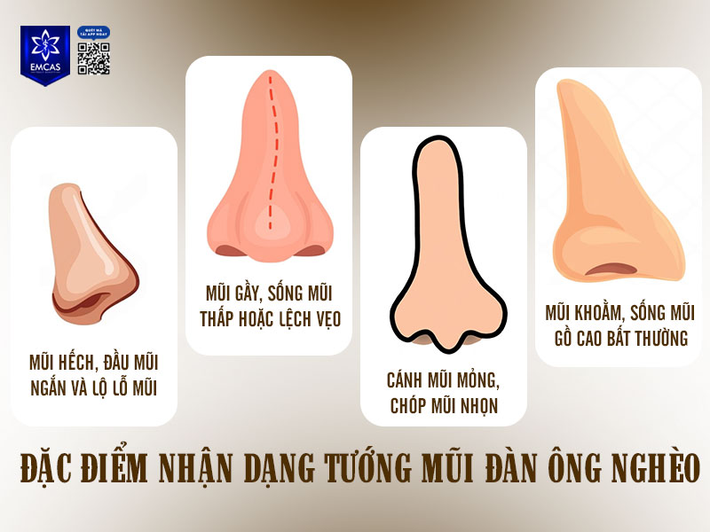 Khái niệm “tướng mũi đàn ông nghèo” thường được dân gian truyền miệng là dấu hiệu của cuộc sống vất vả, khó tích lũy tài sản