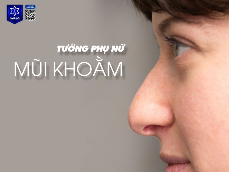 Phụ nữ mũi khoằm thường mang nét cá tính mạnh, độc lập và quyết đoán. Hình 5: text: nâng mũi cấu trúc - chỉnh sửa mũi khoằm
