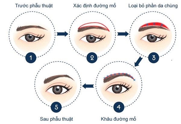 NÂNG CUNG MÀY NỘI SOI