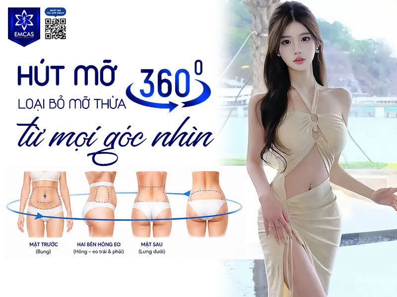 Hút mỡ 360 độ là kỹ thuật tạo hình cơ thể toàn diện quanh vòng eo – thân mình