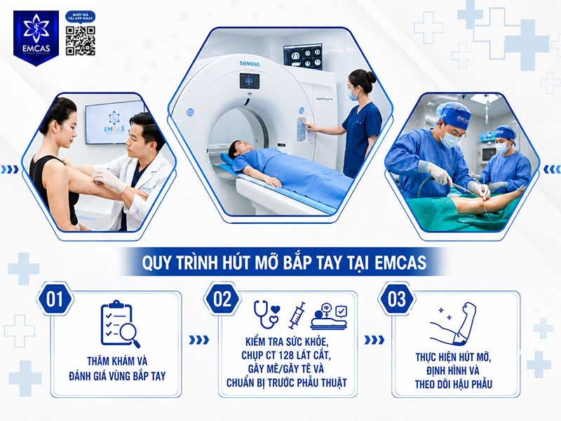 Quy trình hút mỡ tay tại EMCAS được thực hiện theo từng bước từ thăm khám, đánh giá sức khỏe, lập kế hoạch điều trị đến theo dõi hậu phẫu nhằm hỗ trợ kiểm soát an toàn và cá nhân hóa phương án cho từng khách hàng.