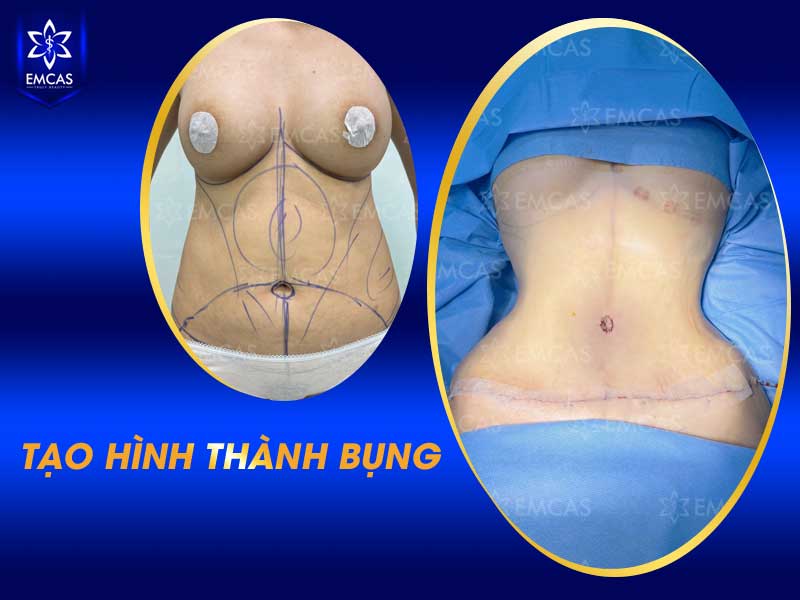 Tại Bệnh Viện Thẩm Mỹ EMCAS, khách hàng được tư vấn cá nhân hóa 