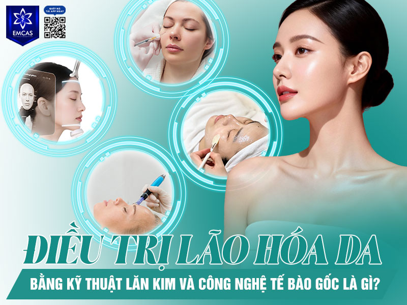Phương pháp điều trị lão hóa da bằng kỹ thuật lăn kim và công nghệ tế bào gốc là sự kết hợp giữa lăn kim bề mặt da, peel da và cấy tế bào gốc nhằm hỗ trợ cải thiện các dấu hiệu lão hóa từ sâu bên trong.